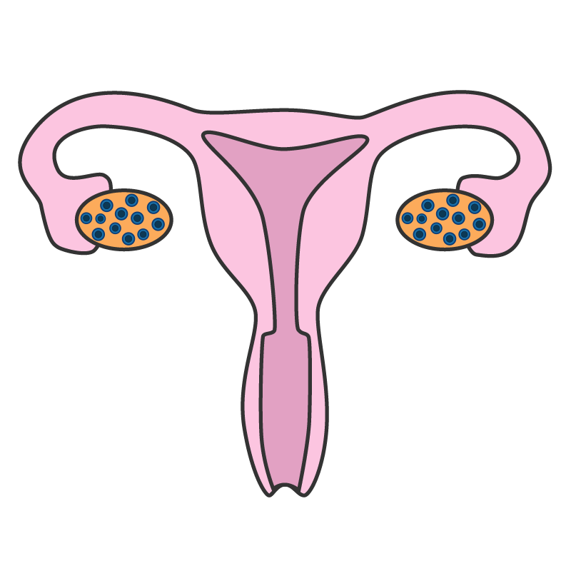 A pink uterus with blue and yellow spots on it.